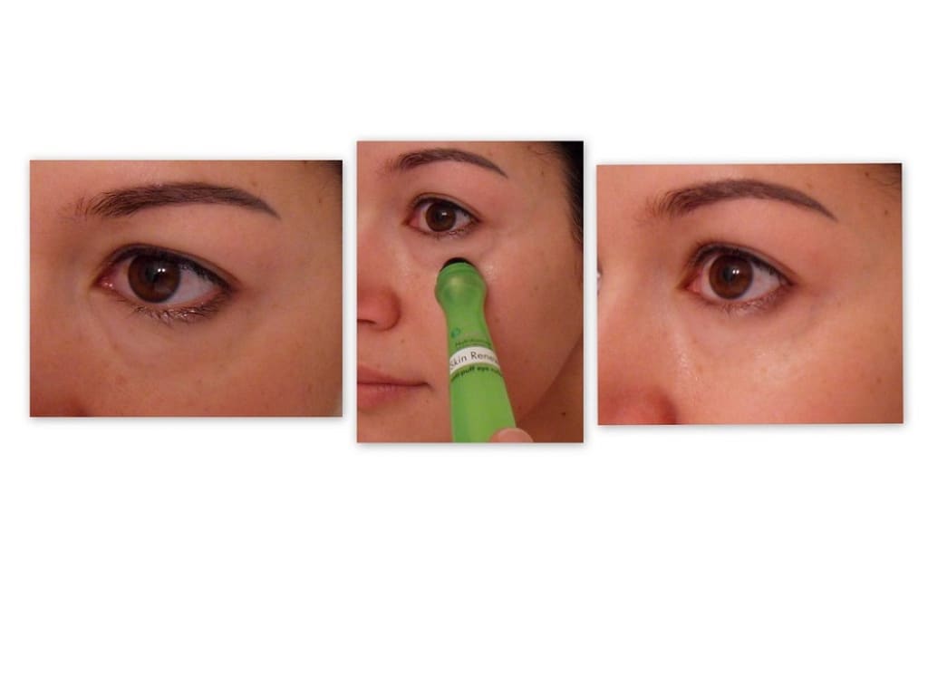 11 Rekomendasi Eye Serum Roll On Terbaik 2024