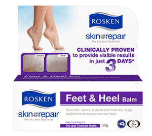 Best for hard skin and dry feet