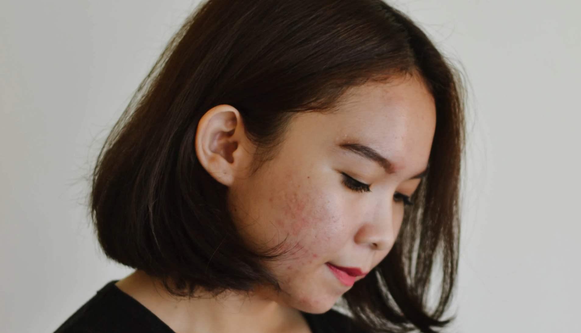 best-primer-acne-skin-singapore.png