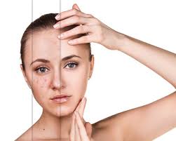 Pilih masker sesuai dengan masalah kulit.jpg