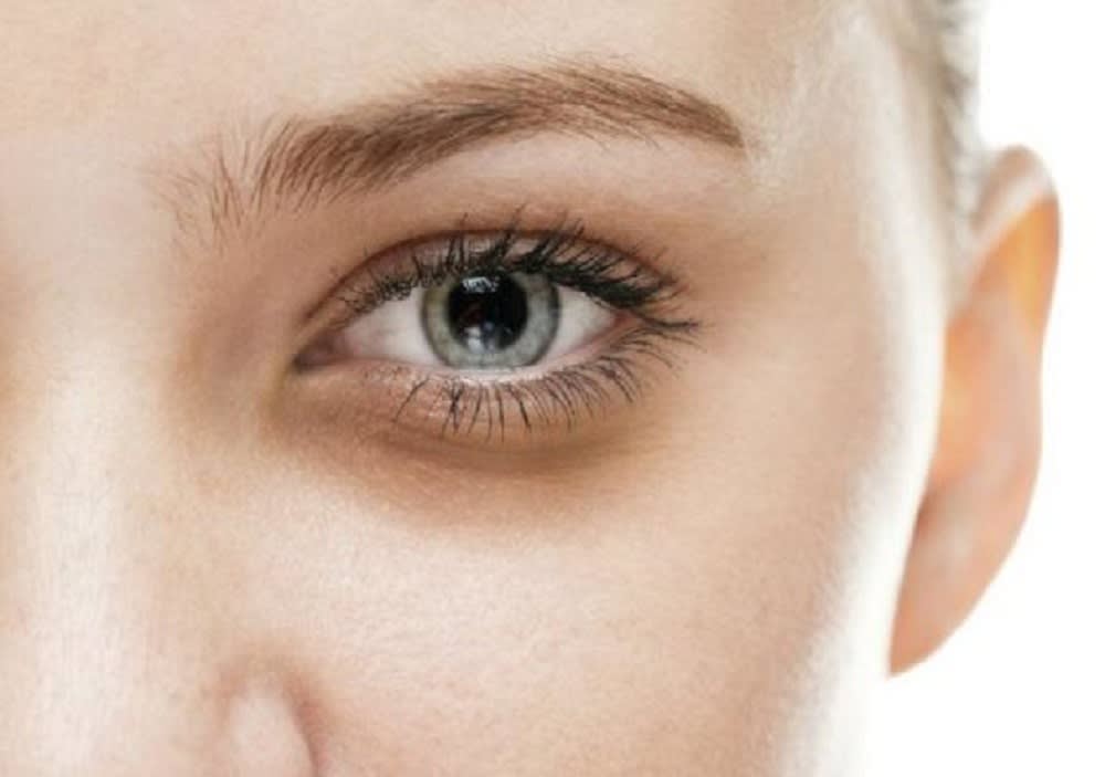Menghilangkan dark circles